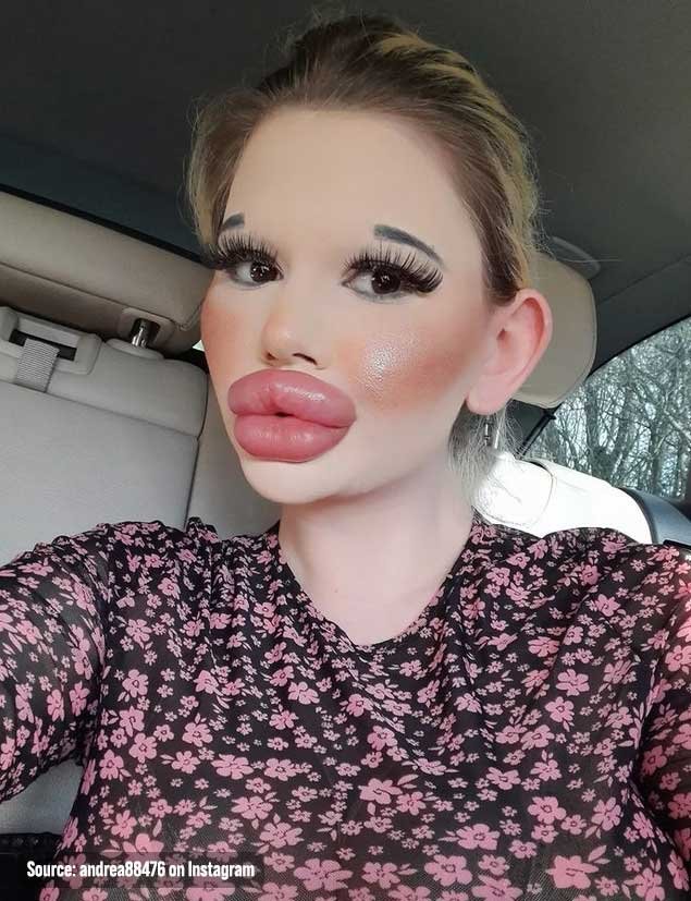 Biggest Lips On Instagram Lipstutorial Org