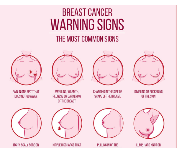 Acacia Family Support - It's Breast Cancer Awareness Month 💗 Early signs  of breast cancer can include a lump in your chest, painful or itchy breasts  and sometimes an unusual discharge from